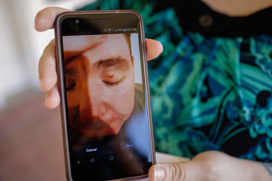 Bryan Gaston's wife shows a photo of an injury to his eyelid that appeared after a prisoner threw feces and urine in his face while he worked at Wilkinson County Correctional Facility.