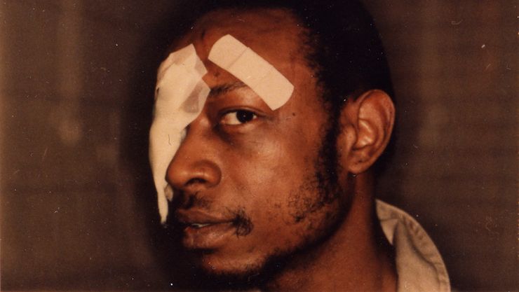 Andrew Wilson said he was punched, kicked, smothered with a plastic bag, electrically shocked and forced against a hot radiator by Chicago police officers in 1982.