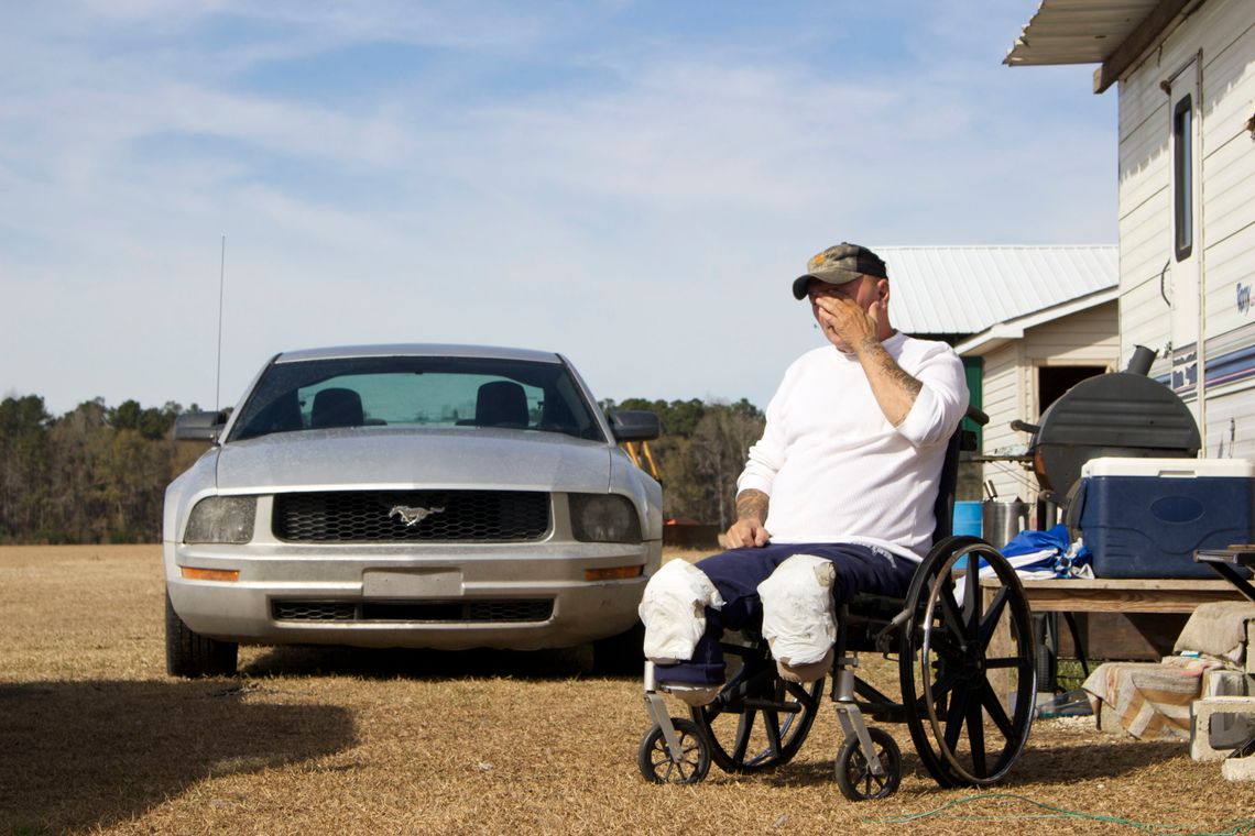 Michael Dykes, who has diabetes, had his legs amputated after spending three days in an Inmate Services Corporation van, traveling from South Carolina to Missouri, in July 2012.