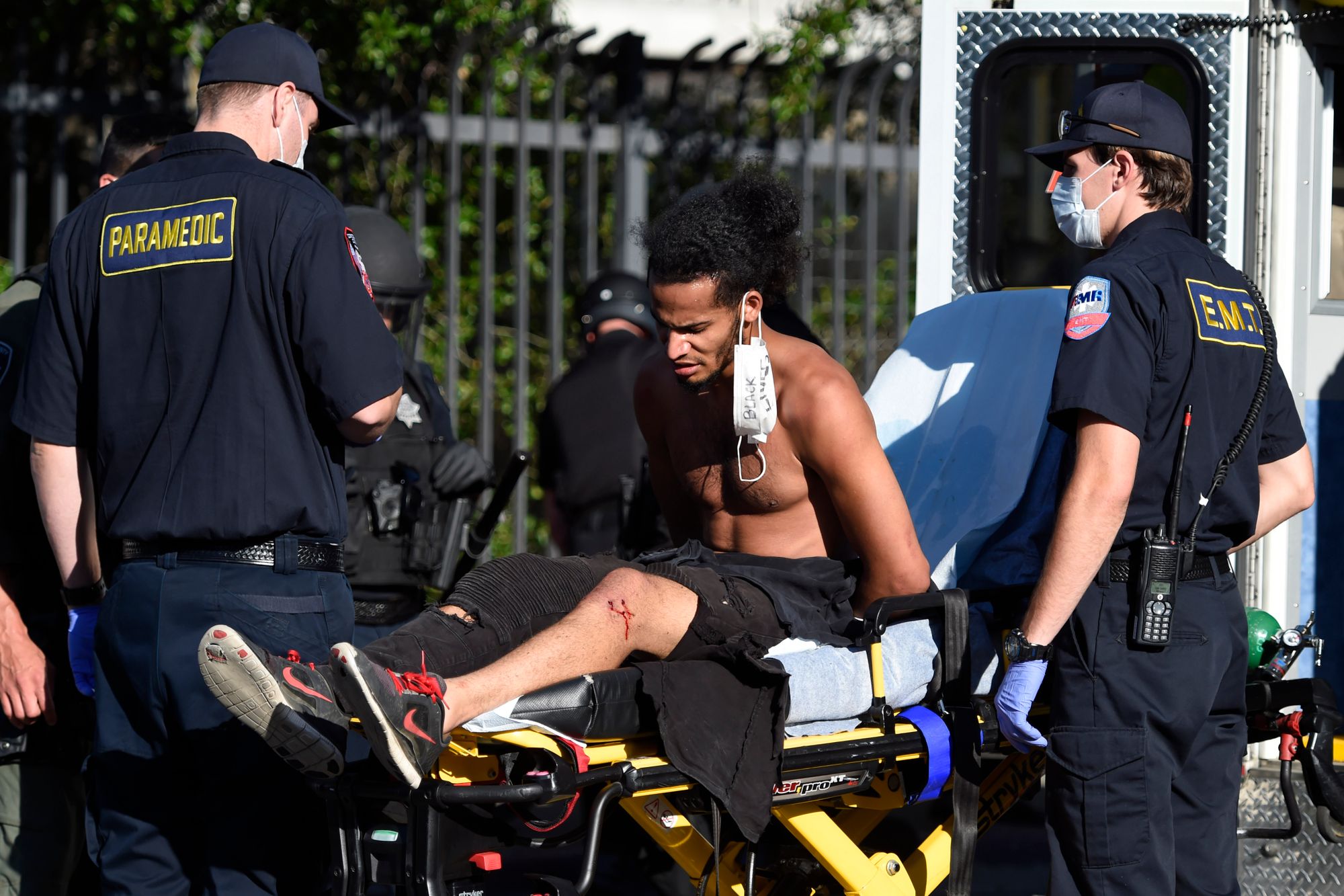 An apparent dog bite can be seen on Malott’s left leg after he was placed on a stretcher.