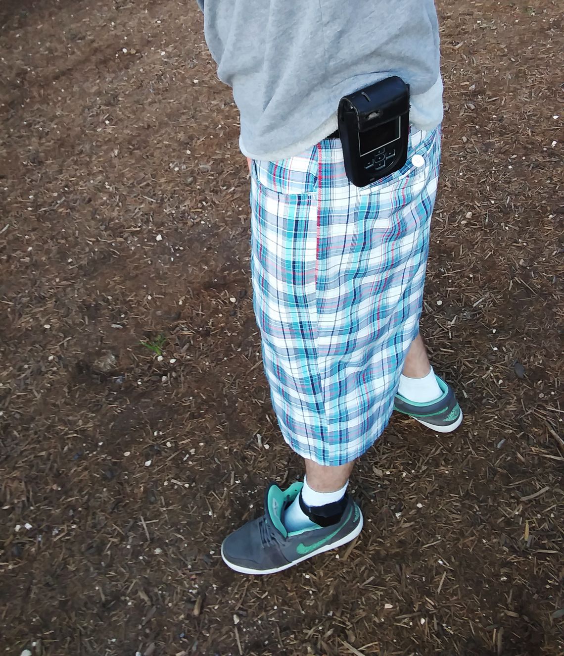 The monitor has two parts — a little box I strap to my hip and a thick rubber ankle bracelet — that I have to carry with me everywhere. The skin around my ankle gets raw, so sometimes I wear two socks.