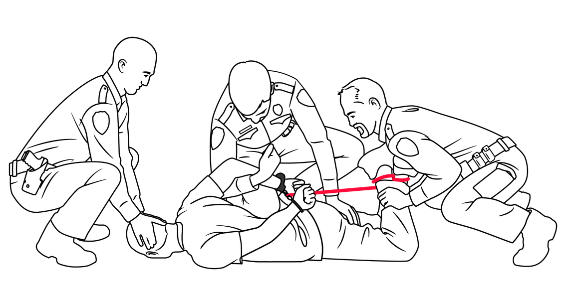 Generally, it can take three or more officers several minutes to get someone down into a hogtie.