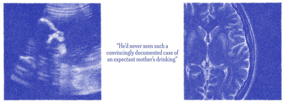 Two blue-toned illustrations show a prenatal sonogram and a brain scan. Between the two illustrations is the text: “He'd never seen such a convincingly documented case of an expectant mother's drinking.” 