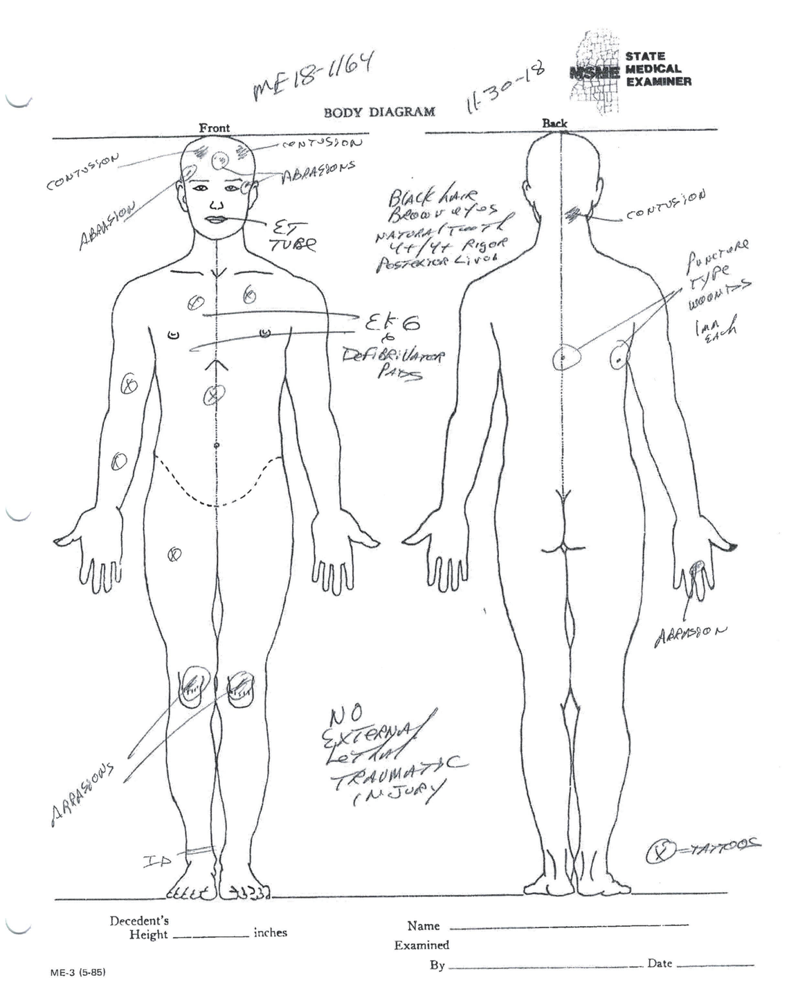 A medical examiner ruled Robert Loggins’s death an accident caused by methamphetamines. But a forensic pathologist said it was a homicide, by asphyxia. He said cuts and bruises on Loggins’ head were consistent with officers and jailers piling on top of him before he died. 