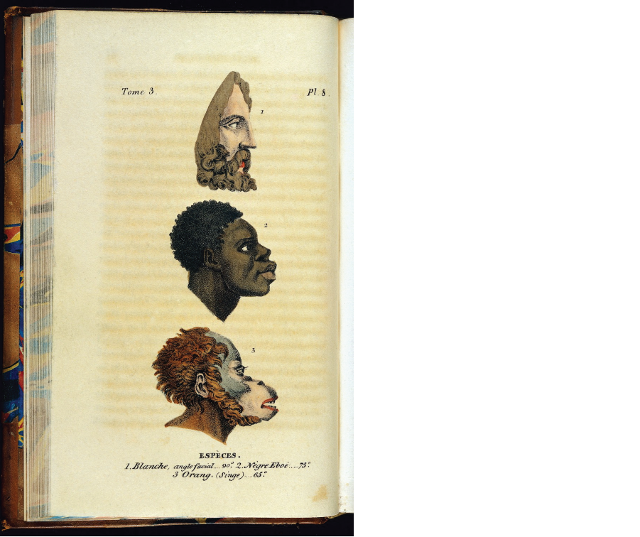 This illustration from an early 19th-century book, “Histoire naturelle de genre humain” by Julien-Joseph Virey, gives a glimpse at how science of the era was used to justify theories of racial inferiority.