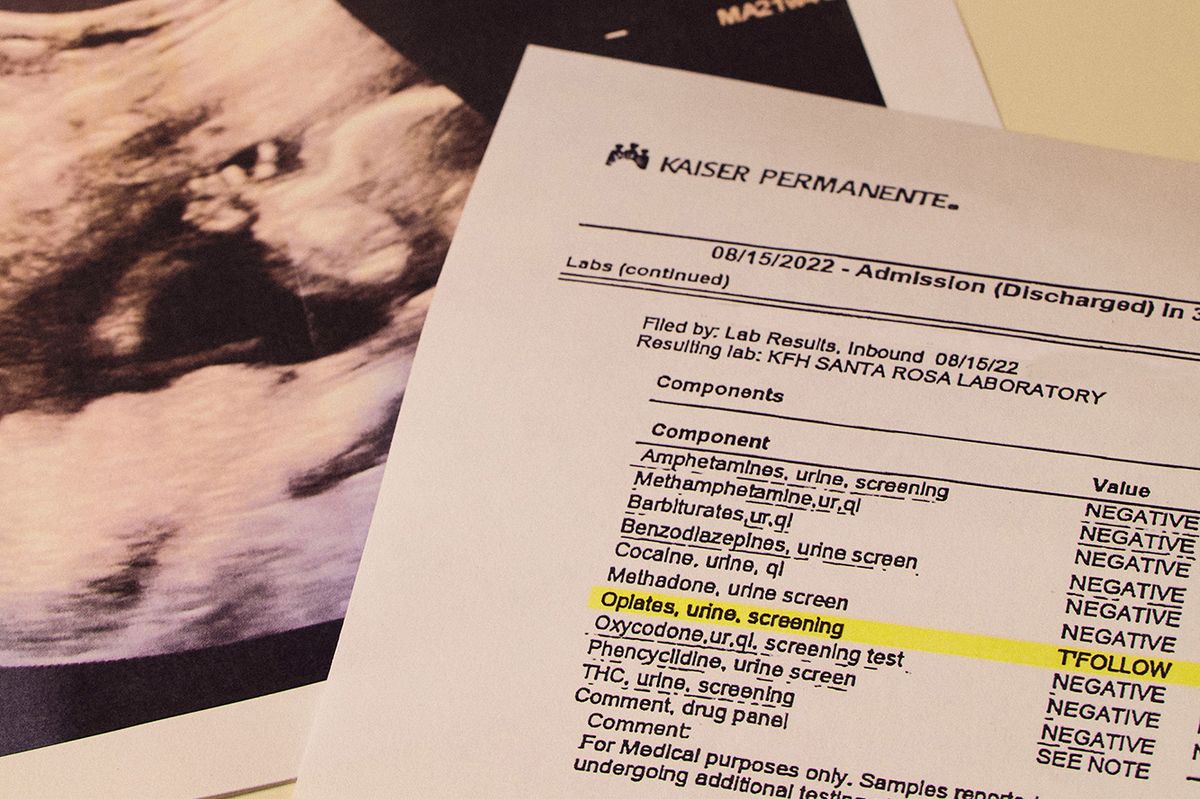 Having a Baby? 5 Tips to Avoid Problems From Flawed Drug Testing at the Hospital