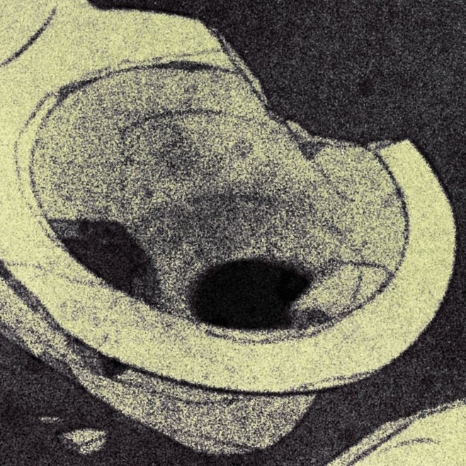 An illustration with muted green tones shows a cracked, dirty toilet bowl. 