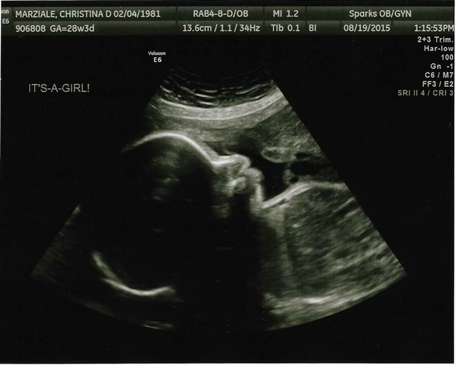 Sonogram image of Marziale’s daughter during her seventh month of pregnancy.