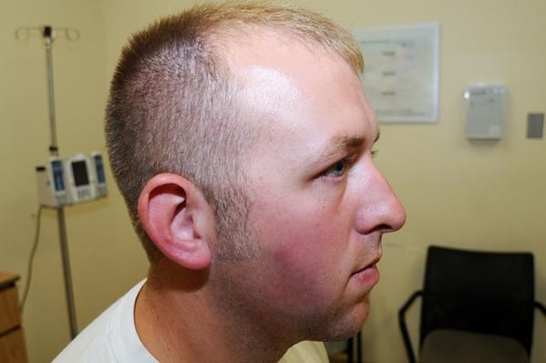 Evidence photos of Darren Wilson released by the St. Louis County Prosecutor’s Office.